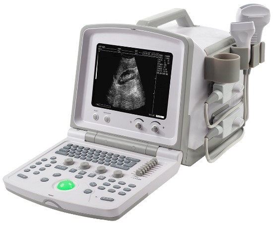 WED-380全数字超声诊断系统