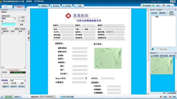 巨渺妇科分泌物检验报告系统 阴道分泌物 白带分析系统软件