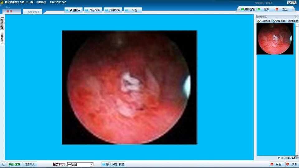 膀胱镜影像工作站 膀胱镜图文工作站 软件支持win10 巨渺科技