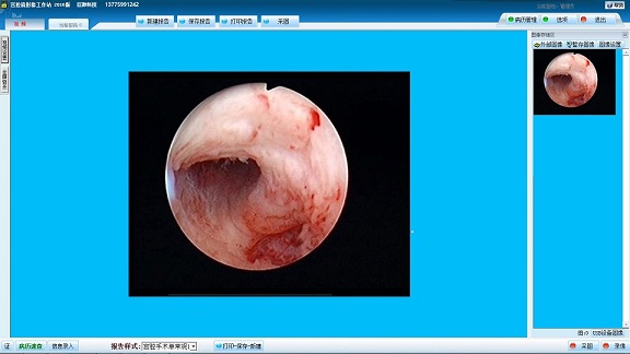 宫腔镜影像工作站 宫腹腔镜手术 录像系统 图文报告软件 win10