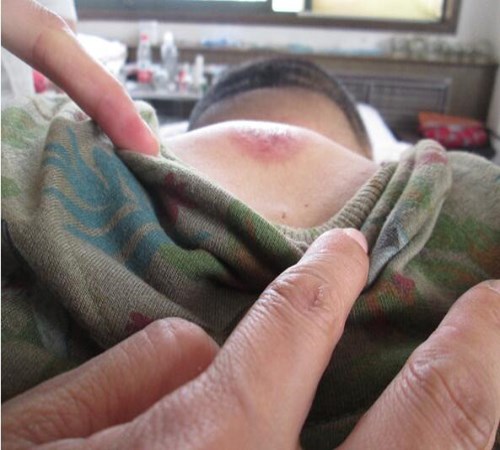 专业正骨培训_颈椎正骨推拿_烟台正骨按摩