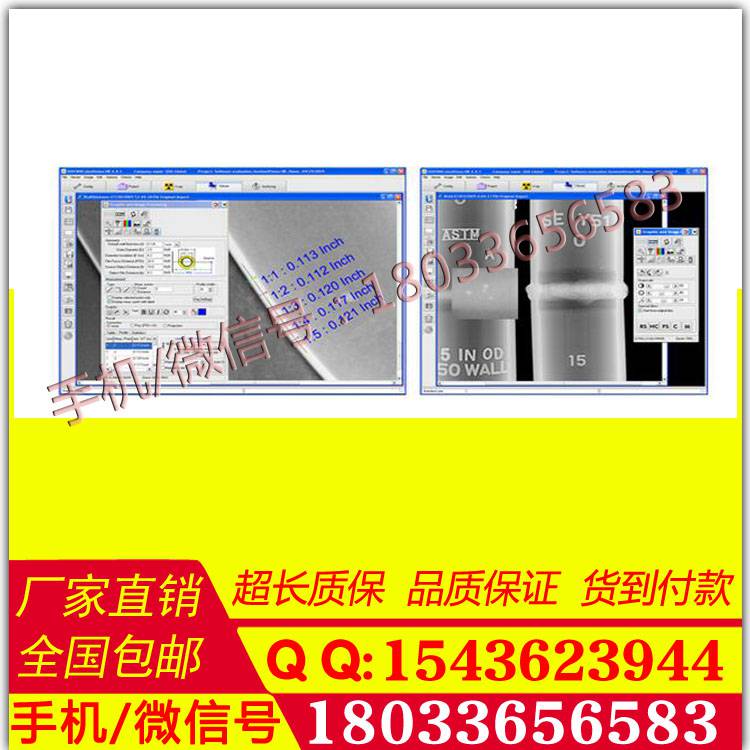 生产销售便携式DR|数字射线|实时成像系统 品质保证