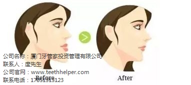 厦门牙齿稀疏能矫正吗|厦门牙齿稀疏的原因   齿度口腔供