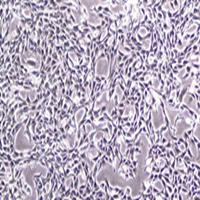 OV-90人卵巢癌细胞