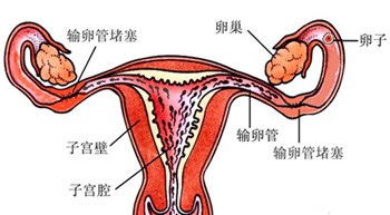 莱芜输卵管堵塞粘连造影专科医院-专业治疗输卵管堵塞粘连造影